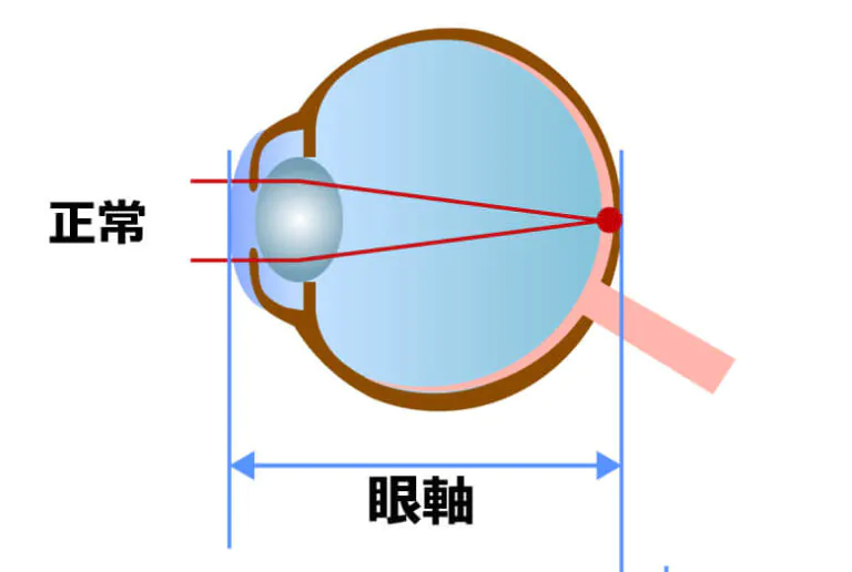 正視