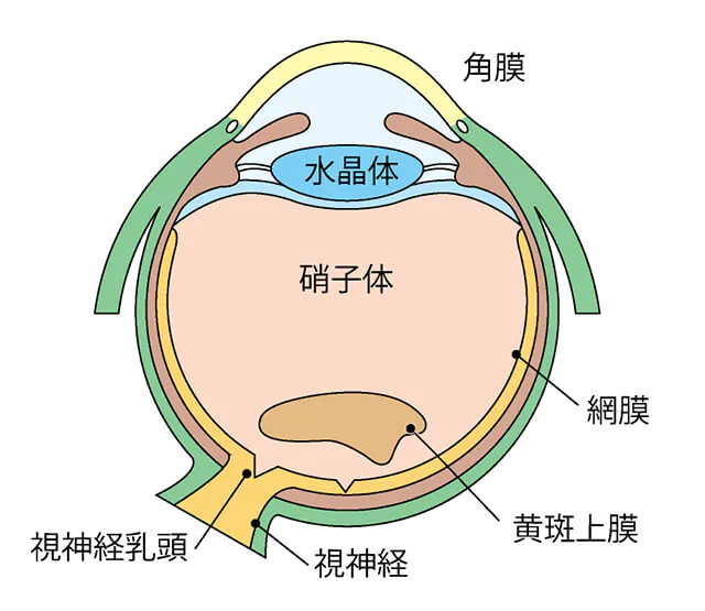 黄斑上膜